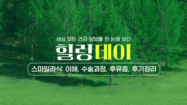 스마일라식: 이해, 수술과정, 후유증, 후기정리